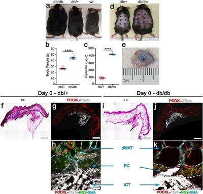 Robust Angiogenesis and Arteriogenesis in the Skin of Diabetic Mice by Transient Delivery of Engineered VEGF and PDGF-BB Proteins in Fibrin Hydrogels